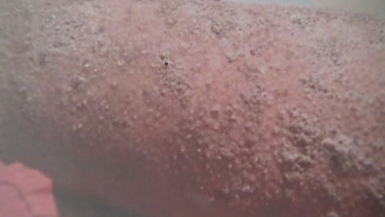 본문 이미지 - 이솜의 머리에서 자라나고 있는 손톱과 유사한 인체조직 (허핑턴포스트) © News1  