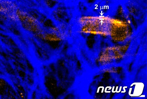 본문 이미지 - 연구단은 고해상도 생체광학영상 구현을 통해 적외선 영역대의 삼광자를 흡수한 나노입자가 오렌지색을 발광, 콜라겐(파란색)으로 둘러싸여 있는 암조직 내부의 2마이크로미터 이하의 혈관벽(오렌지색)을 선명하게 관찰할 수 있었다. © News1 