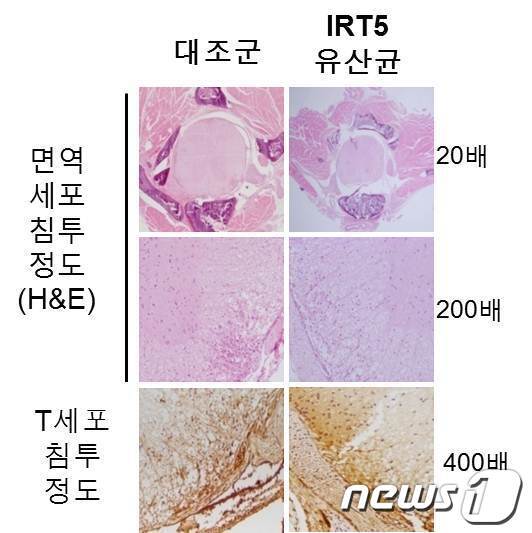 본문 이미지 - 연구팀이 개발한 유산균 혼합물 IRT5이 투여한 의한 다발성경화증 척수내 염증인자 감소 비교 모습././그림제공=광주과학기술원 © News1 