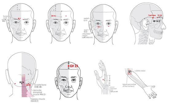 본문 이미지 - 안구건조증 임상연구에 사용된 혈자리로 비염과 마찬가지로 손끝으로 눌러주는 것만으로 증상이 완화될 수 있다고 최 박사는 밝혔다. 각 혈자리 이름은 사진 왼쪽부터 시계방향으로 찬죽, 양백, 승읍, 태양, 사죽공, 곡지, 합곡, 상성, 풍지. © News1 
