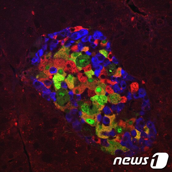 본문 이미지 - 과도한 인슐린 양을 합성해 소포체가 과 활성화된 췌장의 세포 집합체. 인슐린 분비세포(빨간색 부분)들이 죽어 현저히 줄었음을 보여준다. /사진제공=울산대학교 © News1  