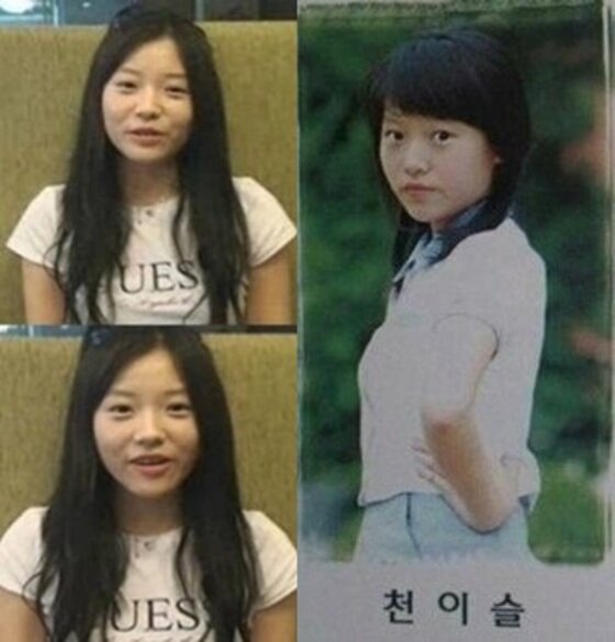 본문 이미지 - 천이슬이 성형외과로부터 피소된 가운데 과거 사진이 화제다. ⓒ대학내일/온라인 커뮤니티
