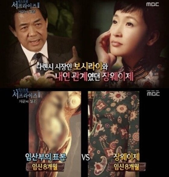 본문 이미지 - 장웨이제 아나운서 일화가 공개돼 충격을 안겼다. ⓒ MBC '서프라이즈' 방송 캡처