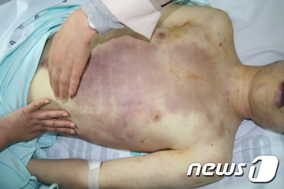 지난 4월 육군 28사단에서  윤 모 일병(23)이 음식을 먹던 중 선임병에 폭행을 당해 끝내 사망한 사건을 수사한 결과 간부까지 가담된 가혹행위가 반복적으로 이뤄진 것으로 확인됐 …