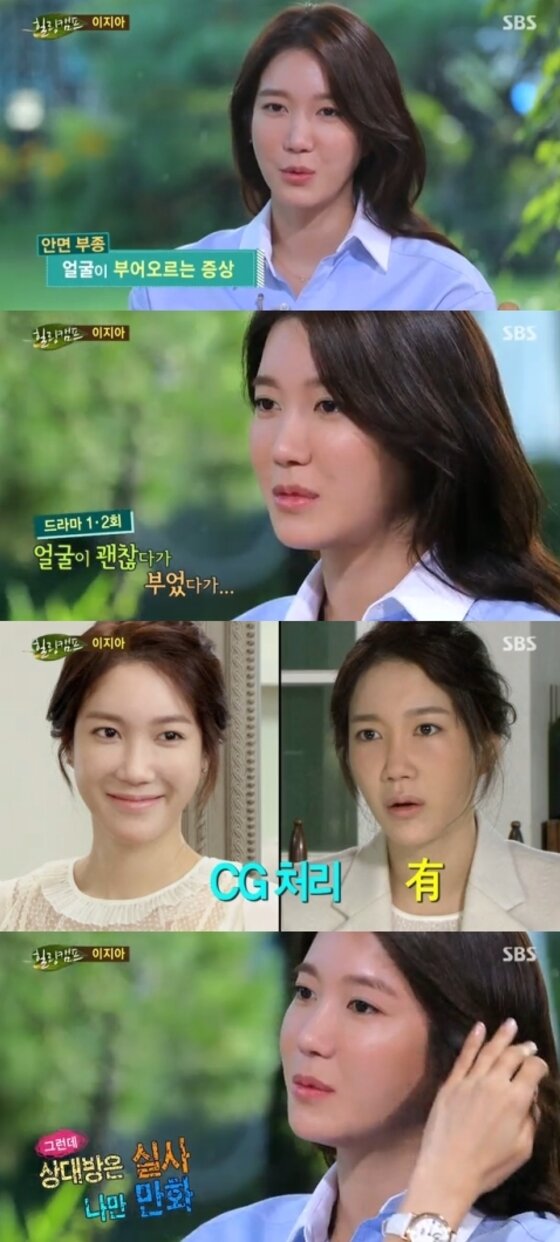 본문 이미지 - 배우 이지아가 지난 11일 밤 11시15분 방송된 SBS '힐링캠프, 기쁘지 아니한가'에 출연해 성형 논란에 대해 입을 열었다. ⓒ SBS '힐링캠프, 기쁘지 아니한가' 캡처