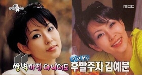 본문 이미지 - '라디오스타'에서 언급된 김예분에 대한 누리꾼의 관심이 집중되고 있다. ⓒ 뉴스1스포츠 / MBC '라디오스타' 캡처