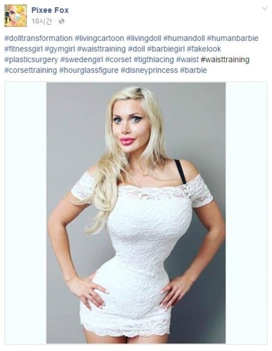 본문 이미지 - 스웨덴 출신의 모델이 만화 속 여주인공처럼 가냘픈 허리를 갖기 위해 갈삐벼 6개를 뽑는 수술을 감행했다. ⓒ News1star /  픽스 폭스 인스타그램