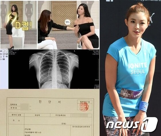본문 이미지 - 유승옥이 가슴성형수술 의혹과 관련해 X레이를 공개한 사실이 새삼 눈길을 끈다.ⓒ News1star/ 유승옥 소속사