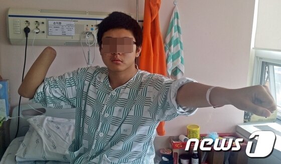 본문 이미지 - 지난 9월11일 대구 50사단 신병교육대대 훈련장에서 수류탄 투척 훈련 중 폭발 사고로 오른쪽 손목을 잃은 손모(20) 훈련병이 입원한 대구 북구 학정동 칠곡경북대병원 병실에서 사고 당시 상황을 재연하고 있다. 2015.11.06/뉴스1 ⓒ News1 배준수 기자