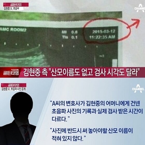 본문 이미지 - 김현중 측이 전 여자친구의 초음파 사진을 공개했다. ⓒ News1스포츠 / 채널A
