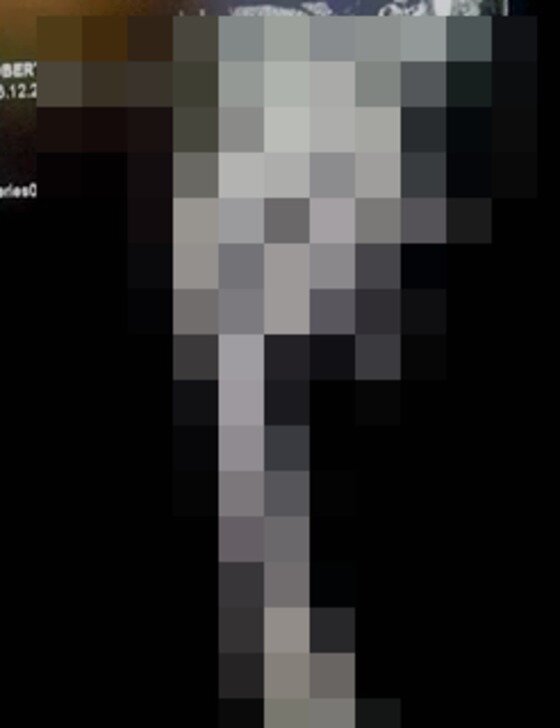 본문 이미지 - 세상에서 가장 큰 성기를 지닌 남성이 화제다.  사진은 X레이 사진의 변형된 모습. ⓒ News1스타 / 유튜브 캡처