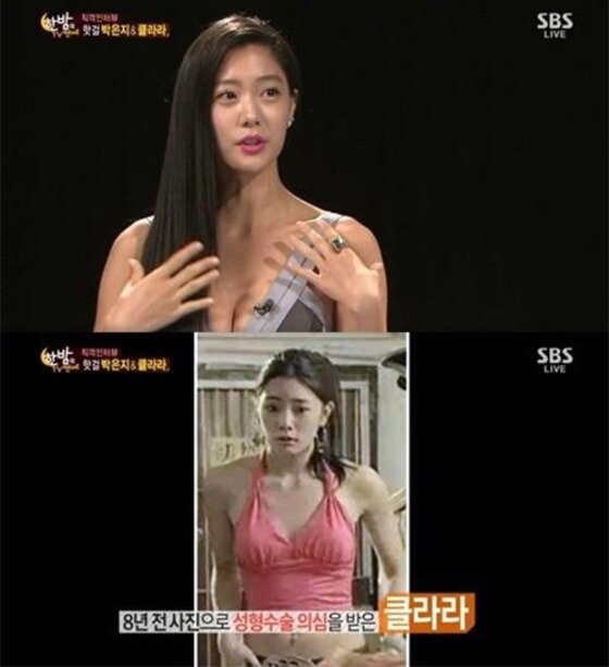 본문 이미지 - '한밤' 클라라가 성형에 대해 언급했다.ⓒ News1star/ SBS '한밤의 TV연예' 방송화면 캡처