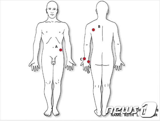 본문 이미지 - 유가족이 실시한 스캇 부검 결과 등, 배, 왼쪽 손 등 최소 3곳에서 총상이 발견됐다.  ⓒ News1