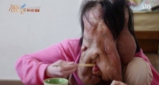 본문 이미지 - '세상에 이런 일이' 제작진이 심현희씨의 후원과 관련한 공지를 올렸다. ⓒ News1star / SBS '세상에 이런 일이' 캡처