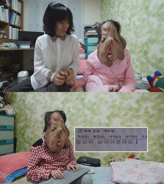 본문 이미지 - 심현희씨가 수술을 받기로 결심하는 모습이 '세상에 이런 일이'를 통해 공개된다. ⓒ News1star / SBS