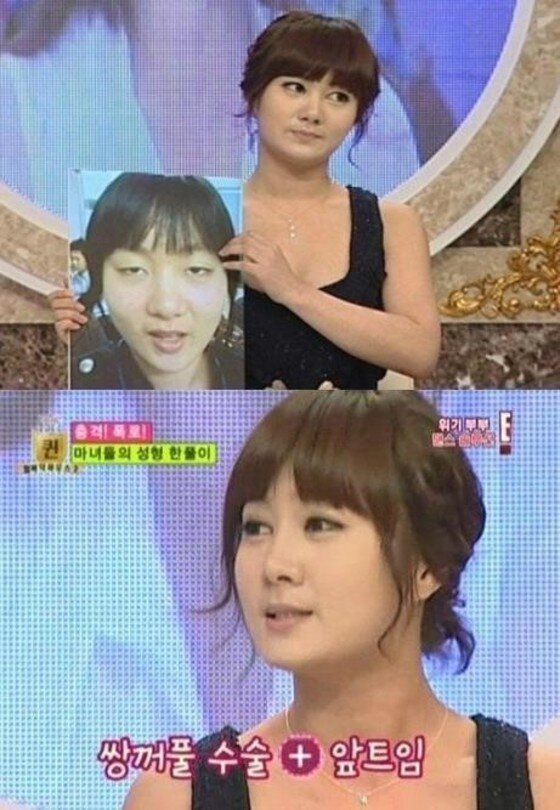 본문 이미지 - '인스타워즈' 박나래가 성형 이후 달라진 점에 대해 밝힌 발언으로 주목받고 있다.  ⓒ News1star / E!TV '철퍼덕 하우스 시즌2-더 퀸' 캡처