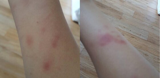 본문 이미지 - 이민호 선수에게 폭행당했다고 주장하는 사람이 올린 사진(인스타그램 캡처) ⓒ News1