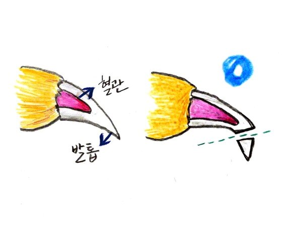 본문 이미지 -  