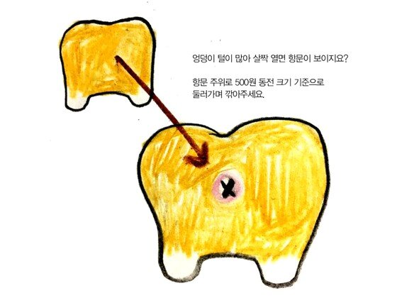 본문 이미지 -  