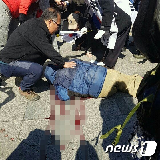 본문 이미지 - 10일 서울 종로구 헌법재판소 앞에서 박근혜 대통령의 탄핵 인용이 결정되자 탄핵 반대 집회 참가자가 피를 흘리며 쓰러져 있다.(독자제공)2017.3.10/뉴스1