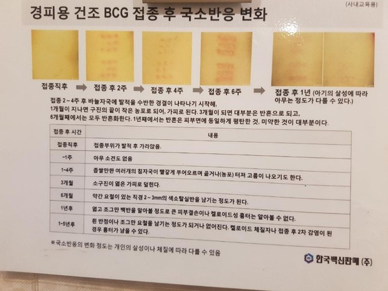서울의 한 산부인과에 게시돼 있는 경피용 BCG 안내문.© News1