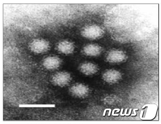 노로바이러스(경기보건환경연구원 제공) © News1 