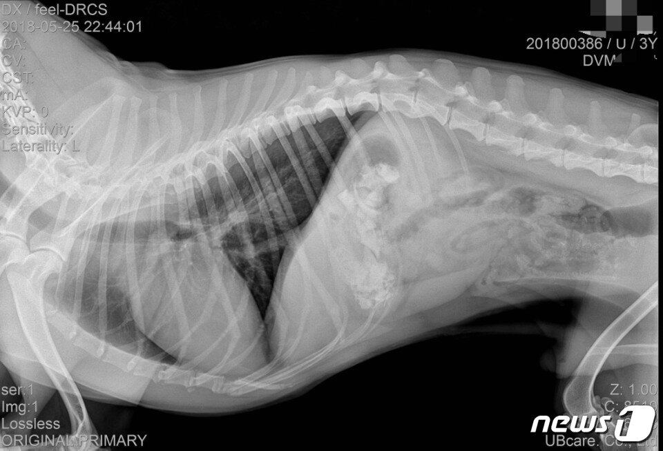 본문 이미지 - 엑스레이에서 발견된 감자탕 뼛조각(사진 김씨 제공).ⓒ News1