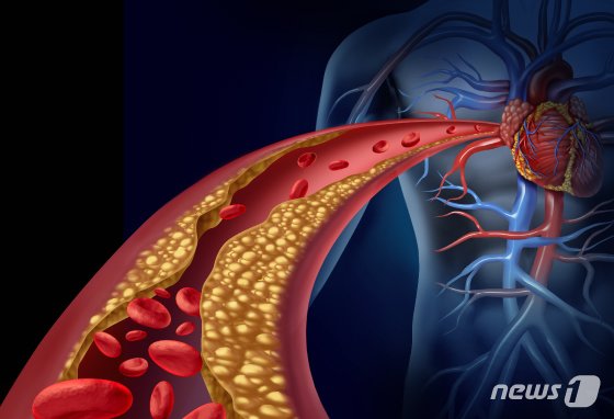 본문 이미지 - ⓒ News1 DB