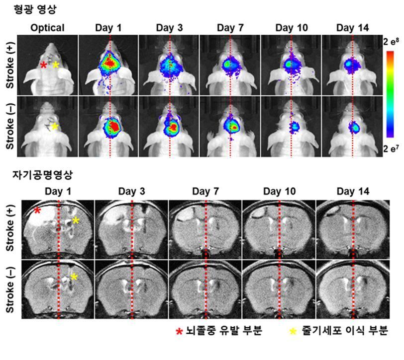 본문 이미지 - 형광/자기공명 복합 영상을 이용한 줄기세포 추적 영상(KIST 제공)ⓒ 뉴스1