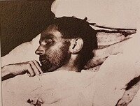 본문 이미지 - 사망 직후의 에곤 쉴레