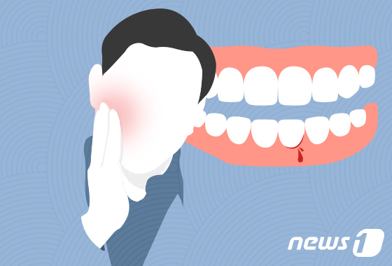 단순 잇몸 염증인 줄 알았는데…8주 지나도 안 낫는다면