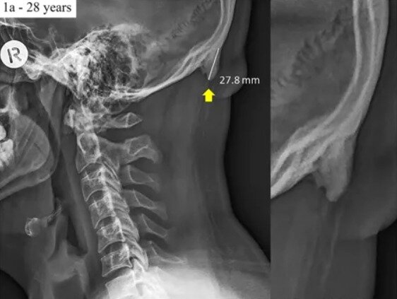 본문 이미지 - 네이처닷컴 화면 갈무리ⓒ nature.com