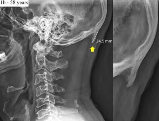 본문 이미지 - 네이처닷컴 화면 갈무리ⓒ nature.com