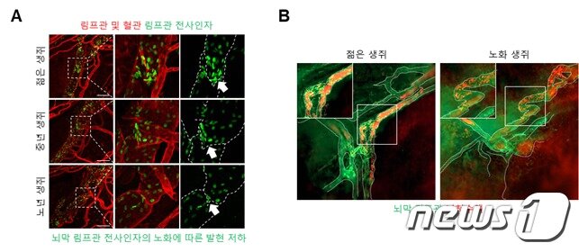 본문 이미지 - 노화에 따른 뇌 하부 뇌막 림프관의 기능 저하(IBS 제공)ⓒ 뉴스1