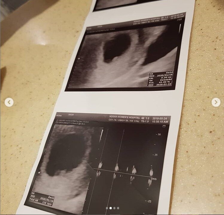 본문 이미지 - 박슬기 SNS ⓒ 뉴스1