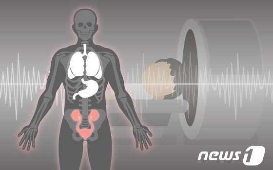 본문 이미지 - ⓒ News1 DB