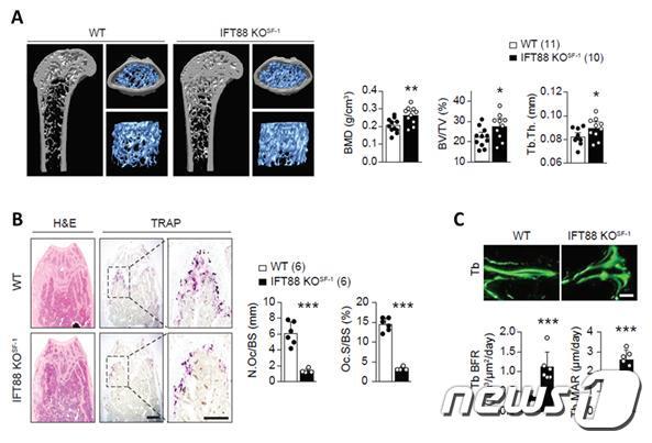 본문 이미지 - 시상하부 복내측핵 일차섬모 결손에 의한 골 항상성의 변화ⓒ 뉴스1