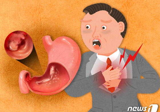 1차 위암검진 때 위내시경 우선 권고…10년 만에 규정 변화