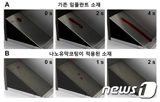 본문 이미지 - 기존 임플란트 소재와 나노유막코팅이 적용된 임플란트 소재 특성 비교. <A>기존 임플란트 소재에서는 혈액이 표면에 잔여물을 남기면서 흐른다. <B>나노유막코팅 임플란트 소재에서는 혈액이 표면에 잔여물을 남기지 않고 굴러 떨어진다. (연세대 서정목 교수 연구팀 제공) ⓒ뉴스1