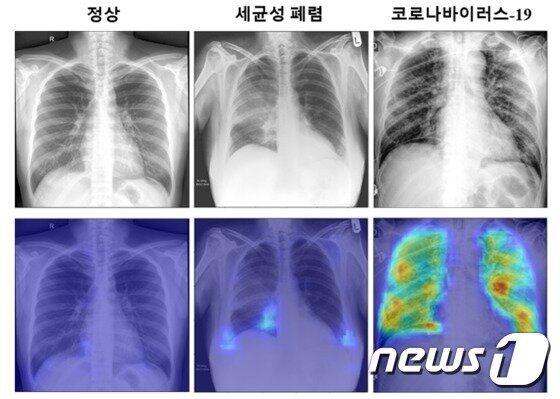 https://image.news1.kr/system/photos/2020/5/25/4207942/article.jpg/dims/optimize https://image.news1.kr/system/photos/2020/5/25/4207942/article.jpg/dims/optimize
