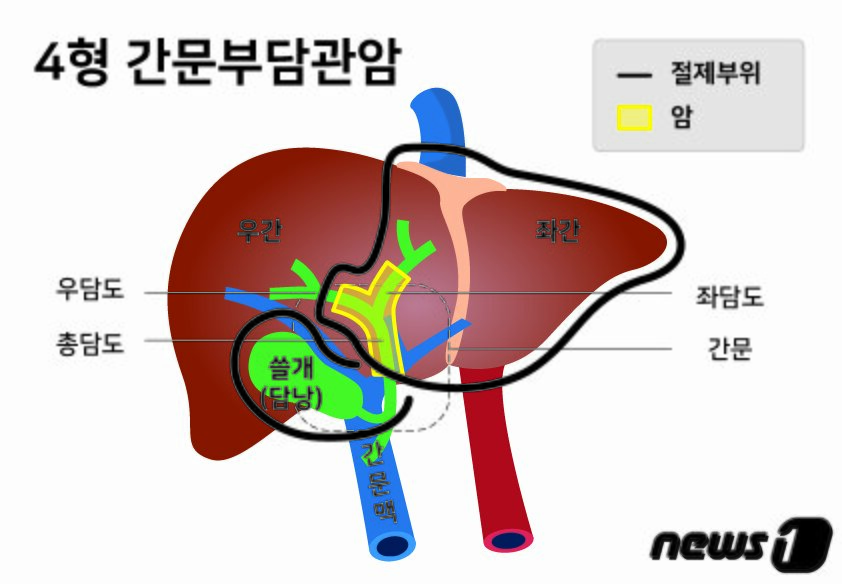 본문 이미지 - ⓒ 뉴스1