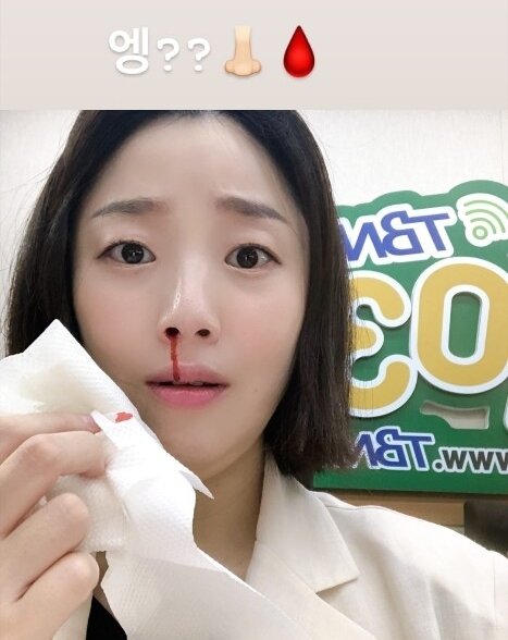 본문 이미지 - 개그우먼 허민 인스타그램 갈무리 ⓒ 뉴스1