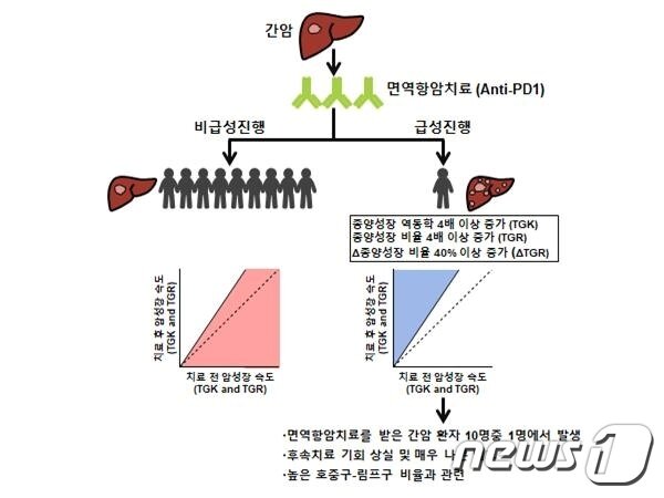 본문 이미지 - 면역항암치료 후 발생하는 간암의 급성진행ⓒ 뉴스1