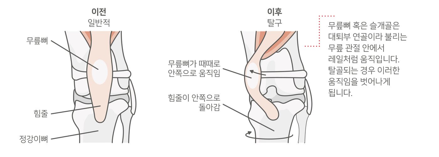 본문 이미지 - 강아지 슬개골 탈구. 사진 로얄캐닌 제공 ⓒ 뉴스1