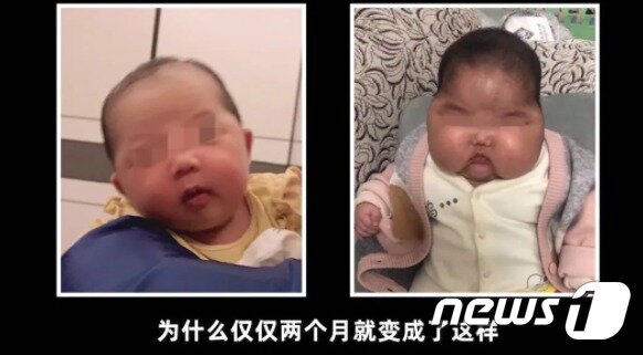 본문 이미지 - 크림을 바르기 전(왼쪽)과 후(오른쪽).(바이두 갈무리)ⓒ 뉴스1