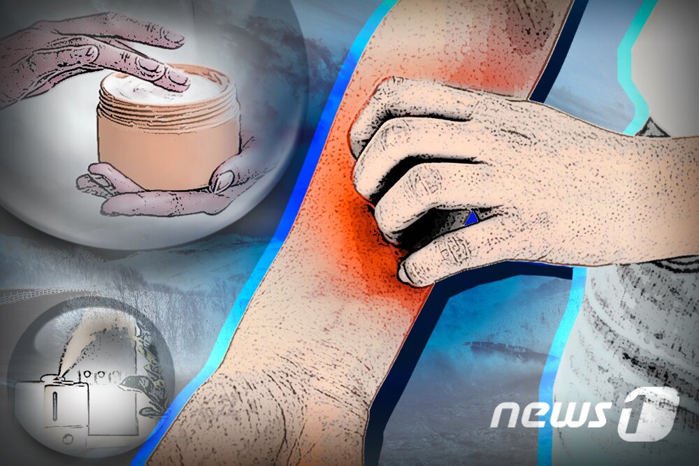 본문 이미지 - 건선은 피부에 붉은 발진과 각질이 생기고, 가려움과 통증이 반복되는 만성 자가면역질환이다. 면역세포가 과도하게 활성화되면서 피부에 지속적인 염증을 일으킨다. 재발과 악화가 반복돼 환자의 신체적·정신적 부담이 크며, 전신으로 확산하는 경우 사회적 고립과 우울증까지 초래할 수 있는 질환이다. ⓒ 뉴스1 김초희 디자이너