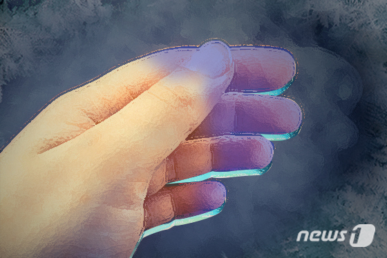 겨울철 손발 하얗게·푸르게 변했다 붉어지는 증상, 왜 생길까