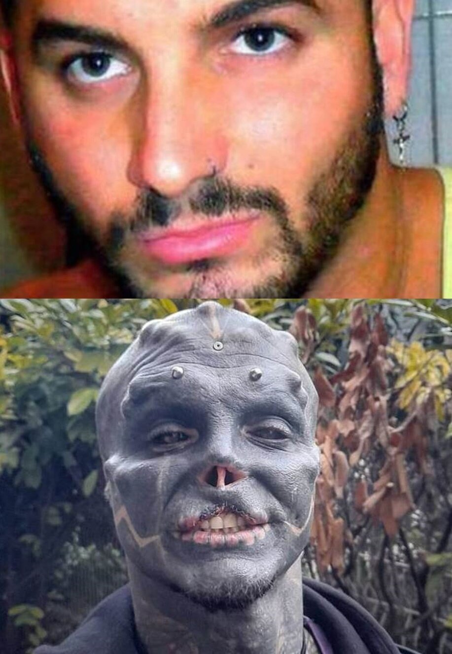 본문 이미지 - 성형 전 로프레도(위)의 성형 후 모습(아래). (인스타그램 갈무리) ⓒ 뉴스1