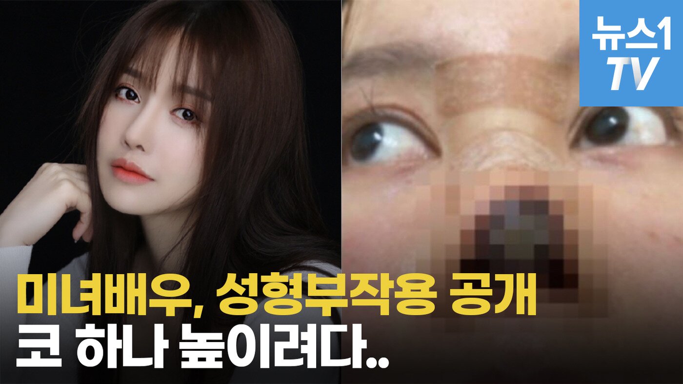 본문 이미지 - ⓒ 뉴스1
