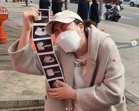 Comedian Hwang Shin-young “Three twins pregnant…I’m happy, but I’m scared a lot”
